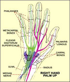 Carpal Tunnel